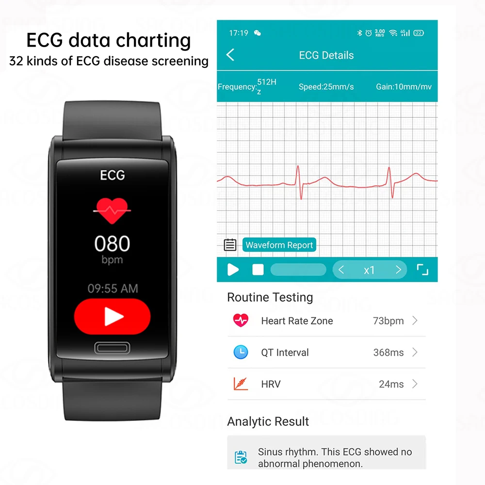 SACOSDING Kraujo Gliukozės Stebėti Sveikatos Smart Watch Vyrų EKG+PPG Kraujo Spaudimo Matavimas IP68 Vandeniui Sporto Moterims smartwatch Nuotrauka 3